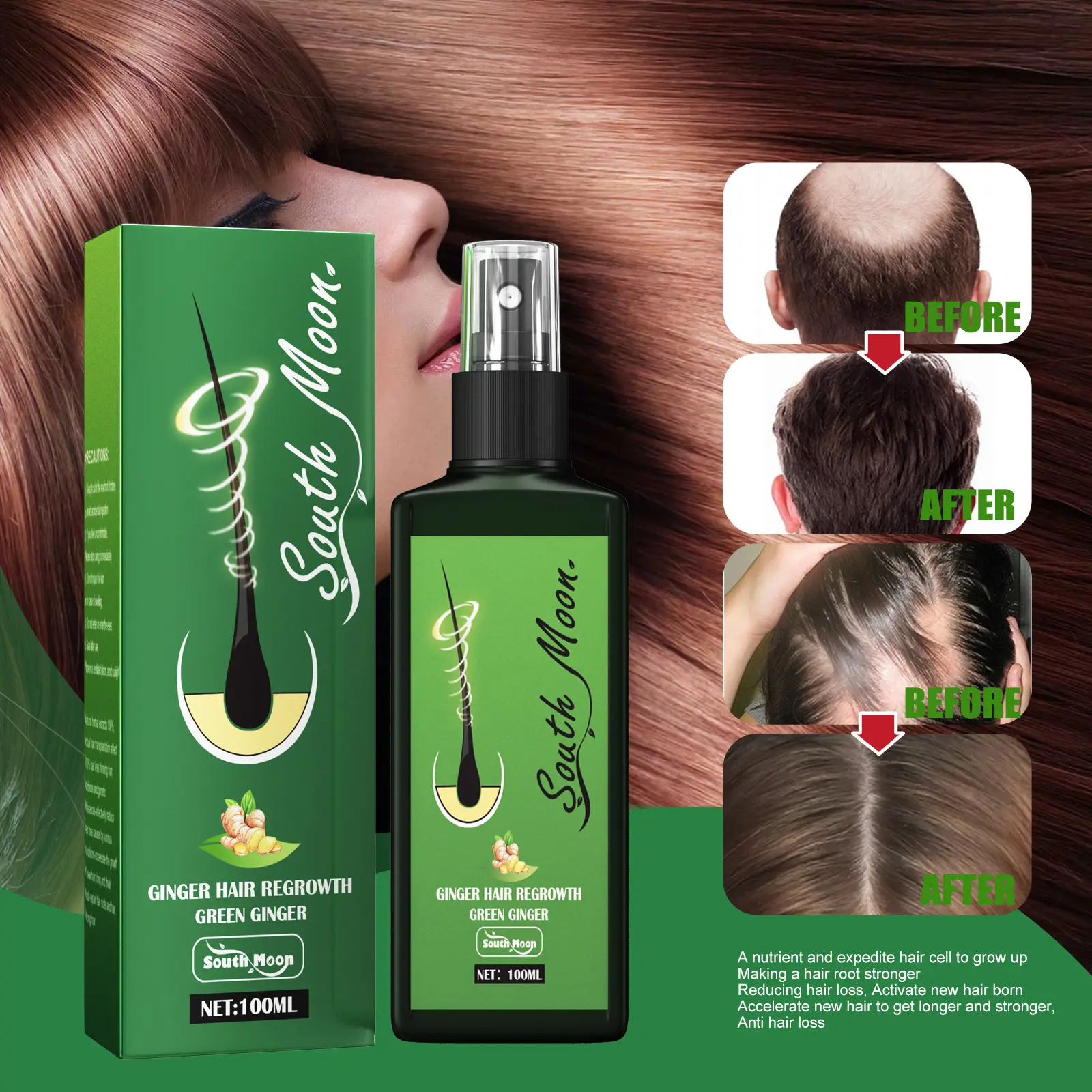 South Moon Ginger Hair Regrowth Gowthgrern Agente de aceite para el crecimiento del cabello Evita la pérdida de cabello Suero nutritivo para el crecimiento