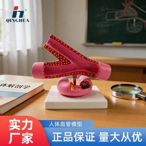 แบบจำลองหลอดเลือดแดง Qinghua QH3318-5, แบบจำลองชีววิทยาสำหรับโรงเรียนมัธยมต้นและมัธยมปลาย, อุปกรณ์การศึกษาวิทยาศาสตร์, ทางการแพทย์ - Product Image 3