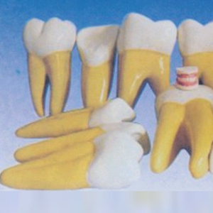 Modèle dentaire médical ADA pour adulte Sylloge (32 dents) – Modèle d'amplification dentaire (15 fois l'agrandissement) pour l'enseignement et l'apprentissage de l'anatomie Shanghai - Product Image 5