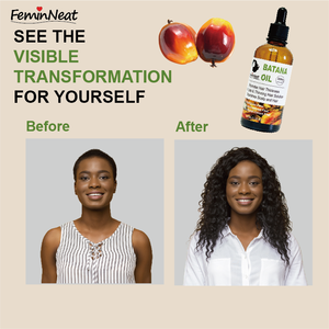 น้ำมัน Batana สำหรับปลูกผมบัตเตอร์ครีมบำรุงผมน้ำมันแบทนาลดการหลุดร่วงของเส้นผมเพิ่มสุขอนามัยให้กับเส้นผม - Product Image 6