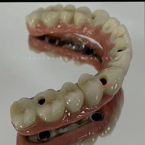 ทันตกรรมรากฟันเทียมทางคลินิกที่มีครอบฟันเซอร์โคเนียและกรอบไทเทเนียมครอบฟันพอร์ซเลนโคบอลต์และโครเมี่ยม - Product Image 6