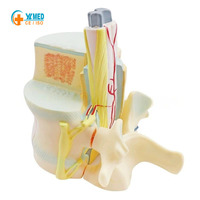Modelo Médico de Columna Vertebral y Vértebras Yulin, Apto para Investigación Ortopédica, Enseñanza de Patología Espinal, Educativo, CE/ISO