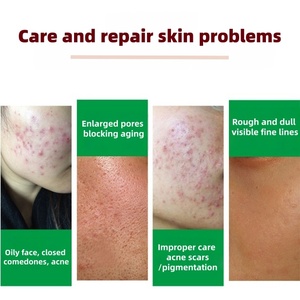 ผงก40% ำจัดสิวเสี้ยนขัดผิวกำจัดคราบจุลินทรีย์ที่ทำให้ผิวขาว - Product Image 6