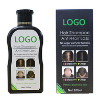 Shampoo anti-chute de cheveux Disaar Organisateur Hommes et femmes Shampooing naturel à la croissance du gingembre pour cheveux abîmés