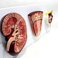 Modelo Anatómico de Glómerulo Renal con Ampliación, PVC, Ciencia Médica