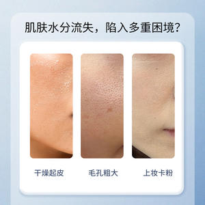 เอสเซอร์บำรุงผิวหน้าเอสเบอร์ ไฮยาลูโรนิค แอซิด 10 มล. ฟื้นฟูและเติมความชุ่มชื้นสำหรับการดูแลผิว - Product Image 4