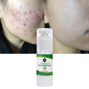 Oem/ODM nhãn hiệu riêng cây trà nổi mụn đốm đen Remover vết sẹo làm sạch sâu mặt chăm sóc da sửa chữa mụn Gel Kem - Product Image 5