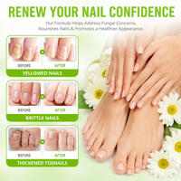 Sérum de Traitement des Ongles au Gingembre 60ml Marque Privée OEM ODM – Réparation Rapide en 7 Jours pour Ongles Jaunes, Épais, Cassants et Soin Antifongique des Ongles des Pieds