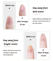 Traitement intensif de récupération des ongles MSJ sur 5 jours, formule à base de plantes, essence naturelle de plantes, 10 ml, qualité salon, ongles soignés