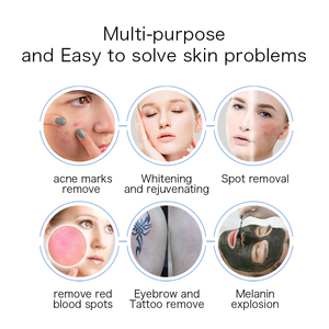 Skin Whitening Brightening Lightening Dark Sopt Pigmentation Removal and Carbon Peeling Machine - Product Image 4