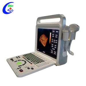 Fournisseur à guichet unique Sonoscape 3D Instruments à ultrasons médicaux Trolley Machine à ultrasons Doppler couleur - Product Image 5