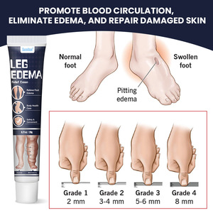 Crema para aliviar el edema de piernas, ungüento para el cuidado de la salud corporal para eliminar el edema - Product Image 3