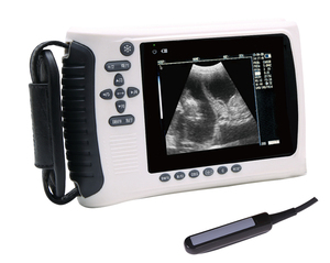 Appareil d'échographie vétérinaire pour la détection <span class=keywords><strong>de</strong></span> la gestation - Système portable <span class=keywords><strong>de</strong></span> surveillance du bétail haute définition - Product Image 4
