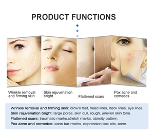 Máy làm đẹp mặt 2 trong <span class=keywords><strong>1</strong></span> di động, nâng cơ mặt, làm săn chắc da, làm sạch da mặt, giảm nếp nhăn và cải thiện độ đàn hồi của da, máy <span class=keywords><strong>Morph</strong></span> 8 - Product Image 3