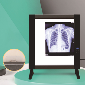 <span class=keywords><strong>Negatoscopio</strong></span> Médico LED para Rayos X, Visor de Películas de Rayos X de Unión Única, Fuente de Alimentación Eléctrica - Product Image 6