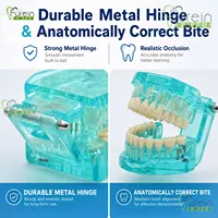 Modèle de Restauration Dentaire avec Dents Amovibles, Modèle de Démonstration de Couronne et Pont Implantaire pour l'Éducation et la Formation des Dentistes