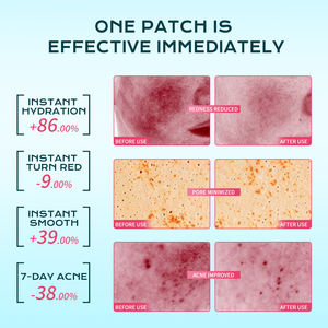 Almohadillas de algodón para eliminar el acné con ácido salicílico de marca privada IREV, 80 tabletas, hidratantes y calmantes para la piel con acné, almohadillas de algodón OEM para limpieza de la piel. - Product Image 4