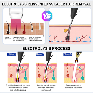 Removedor de Verrugas y Acrocordones, Depilación por Electrólisis con Aguja K4*100, Máquina de Electrólisis, Eliminación de <span class=keywords><strong>Venas</strong></span> Vasculares, Equipo de Belleza - Product Image 3