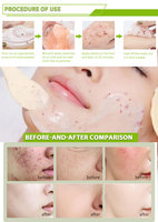 100% Extrait naturel pour Hydro Jelly Powder Mask Roya Masque blanchissant instantané sucré pour le visage et le corps