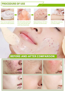 100% Extracto natural <span class=keywords><strong>para</strong></span> Hydro Jelly Powder Mask Roya Endulzado Blanqueamiento instantáneo Mascarilla facial y corporal - Product Image 3