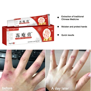 <span class=keywords><strong>Crema</strong></span> Idratante Invernale Anti-Prurito Riparatrice <span class=keywords><strong>per</strong></span> Dita Screpolate con Lanolina ed Estratti Naturali di Erbe - Product Image 3