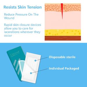 เทปกาวทางการแพทย์เย็บปราศจากเชื้อแบบใช้แล้วทิ้งเทปที่ปราศจากเชื้อมีความยืดหยุ่นดี - Product Image 6