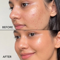 Salisilik Asit Yüz Yıkama Tozu BHA Peeling Temizleyici Akneye Meyilli Yağlı Hassas Cilt Siyah Nokta Derin Gözenek Temizleyici Toptan Satış