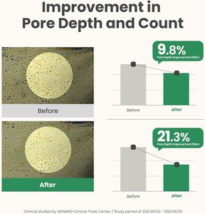 قناع طين لانس من العلامة التجارية الخاصة مقشر للوجه يستهدف المسام المسدودة مزيل الرؤوس السوداء قناع Mugwort - Product Image 6