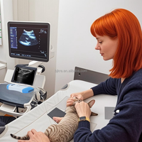 Scanner à ultrasons Doppler couleur sans fil pour chiens chats cochons moutons vaches chevaux équipement de diagnostic vétérinaire