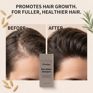 <span class=keywords><strong>Shampoo</strong></span> <span class=keywords><strong>per</strong></span> la Crescita dei <span class=keywords><strong>Capelli</strong></span> con Logo Personalizzato, Volumizzante e Purificante Profondo con Acqua di Riso e Proteine <span class=keywords><strong>per</strong></span> Donne e Uomini - Product Image 3