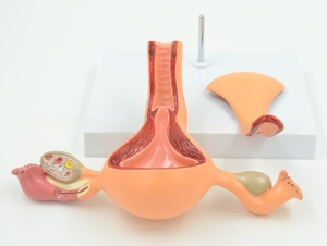 Le modèle de système reproducteur anatomique féminin en PVC pour l'éducation médicale comprend l'utérus, le vagin et l'ovaire avec pathologie - Product Image 3