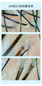 Microscopio Digital para Cabello de 15 Pulgadas, Analizador de Folículos Capilares para Uso Doméstico, Detector de Piel y Analizador de Cuero Cabelludo - Product Image 6