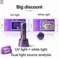 HT-BW36 Smart WIFI Scalp Hair Analyzer AI Analisis Otomatis 5 Item Utama untuk Uji Kepadatan Rambut & Kerontokan Rambut