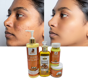 ชุดครีมบำรุงผิวสำหรับรักษาสิว tumeric + <span class=keywords><strong>gluta</strong></span> <span class=keywords><strong>PLUS</strong></span> สารเพิ่มความขาวต่อต้านริ้วรอยและสิว - Product Image 5