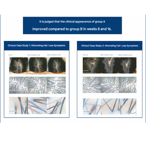 Mascarilla Capilar Orgánica Detox D3 de 400 ml, Acondicionador Profundo a Base de Hierbas, Tratamiento Anticaída, Nutritivo, Brillante y para el Crecimiento del Cabello, para Todo Tipo de Cabello - Product Image 5