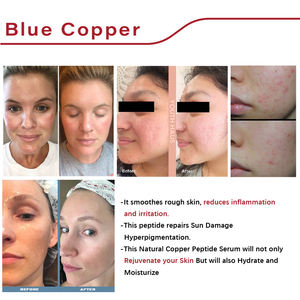 Redcooleaf 5ml + 50mg כחול נחושת פפטיד קולגן תיקון אהה אנטי טיפוח עור פנים תיקון אמפולה סרום - Product Image 3