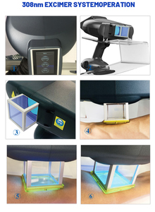 Système Excimer 308 nm pour le traitement médical de l'eczéma, du psoriasis et du vitiligo, analyseur cutané portable efficace pour le diagnostic ciblé des métaux - Product Image 6