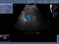 Mesin USG Doppler Warna Portabel Premium Veterinary N20 dengan Layar LED Definisi Tinggi untuk Klinik Hewan