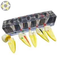 Modèle dentaire de mandibule en PVC pour formation médicale, taille réelle, évolution pathologique des dents, caries, périostite, sciences médicales