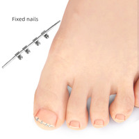 Traitement des ongles incarnés Correcteur d'ongles incarnés pour la réparation des ongles incurvés et le lisseur d'ongles incarnés