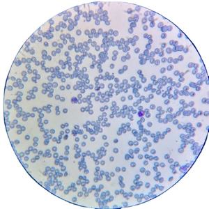 Mikroskop-Objektträger Hochwertige Hämatologie-Objektträger Blutstreifen-Objektträger - Product Image 1