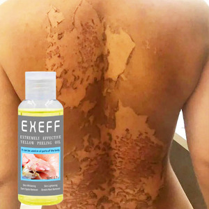OEM Extra Strength желтое пилинг масло черная кожа сильное Отбеливающее масло для удаления кожи Африканское Отбеливающее желтое пилинг масло - Product Image 1