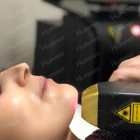 2025 Titane Nouveau Xl Ice Laser Diodo 808 Diode Laser Épilation Machine Titane Diode Laser 755 808 1064 Platine