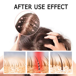 ขายส่ง<span class=keywords><strong>แชมพู</strong></span>ซากุระทําความสะอาดหนังศีรษะอย่างล้ําลึกซ่อมแซมความเสียหายของฟอลลิคูล<span class=keywords><strong>ผม</strong></span> เสริมความแข็งแกร่งของเส้นผมและป้องกันผมร่วง - Product Image 6