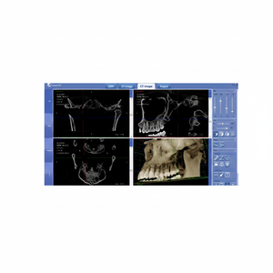 Appareil de radiographie panoramique dentaire 3D CBCT avec fonction céphalométrique numérique - Product Image 1
