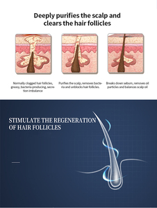 Analyseur de cuir chevelu 3 en 1, traitement du cuir chevelu, soin des cheveux pour instituts capillaires, scanner de test du cuir chevelu pour analyse de la peau - Product Image 4