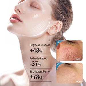 Suero Personalizado <span class=keywords><strong>con</strong></span> 0.5% de Feniletil Resorcinol para Aclarar y Desvanecer Manchas Oscuras <span class=keywords><strong>con</strong></span> 2% de Niacinamida - Product Image 6