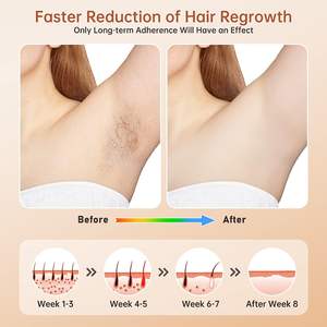 Depiladora portátil multifuncional para uso doméstico, cabezales intercambiables, depilación sin dolor, brillo de la piel, reducción del acné Oem/ODM - Product Image 5