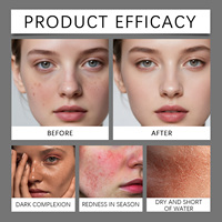 Crème Visage au Squalane et Céramide, Hydratante et Réparatrice, à la Niacinamide, Soin Quotidien pour la Barrière Cutanée
