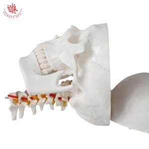 Modèle de colonne vertébrale cervicale de crâne humain FRT023 modèle de crâne d'artère carotide occipitale modèle de crâne de Communication médecin-patient orthopédique - Product Image 5